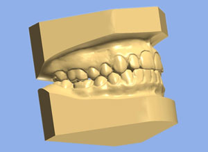 Digital Study Model