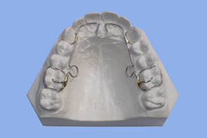 TMJ Splints