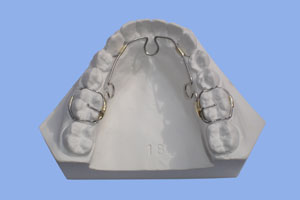 TMJ Splints