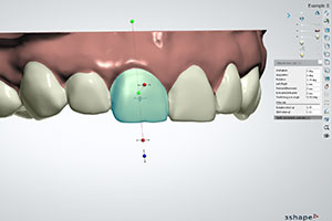 arrow ortholigner.