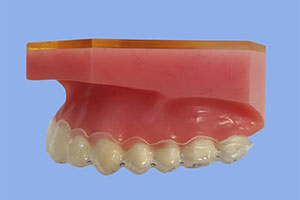 Tooth Whitening Trays