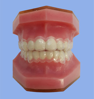 Whitening Trays